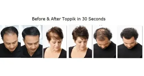 Fibras Capilares Toppík #1 Para Caída Del Cabello Americano - Imagen 7